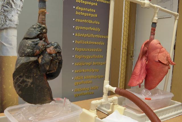 Dohányzásmentes Világnap - pedagógusokat és védőnőket tájékoztattak a káros hatásokról Dohányzásmentes Világnap - pedagógusokat és védőnőket tájékoztattak a káros hatásokról