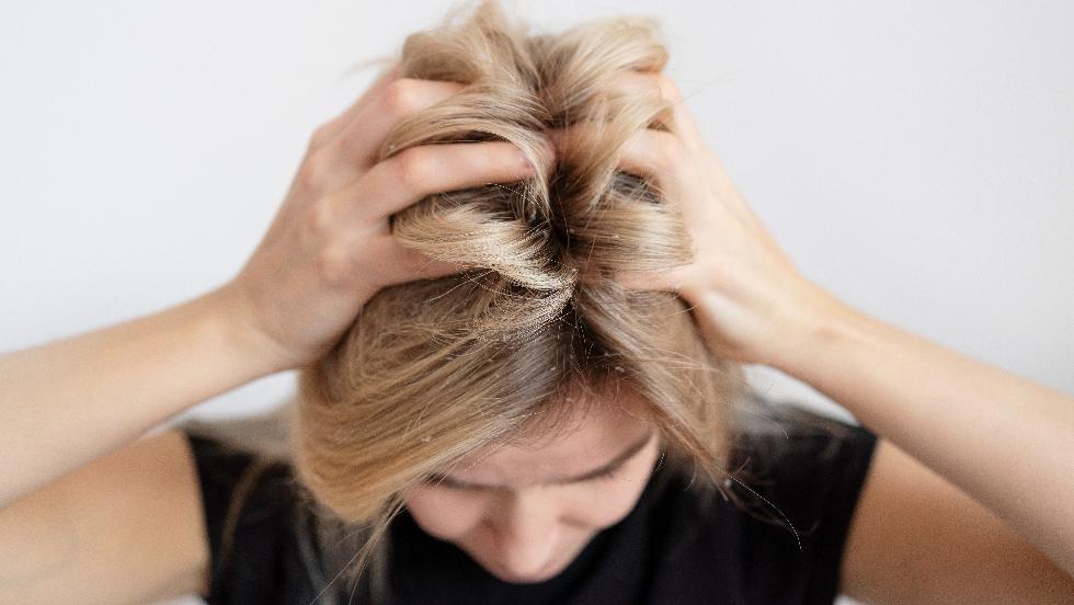 Hajhullás: nem csak vitaminhiány állhat a háttérben Hajhullás: nem csak vitaminhiány állhat a háttérben