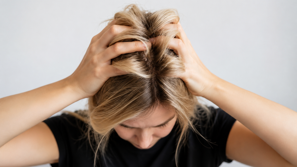 Hajhull�s: nem csak vitaminhi�ny �llhat a h�tt�rben
