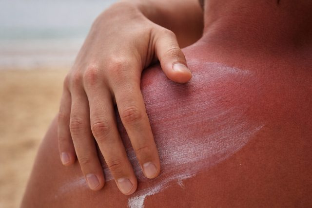 Er�s az UV-sug�rz�s