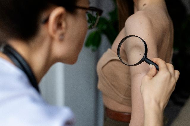 Most �rdemes levetetni a zavar� anyajegyeket