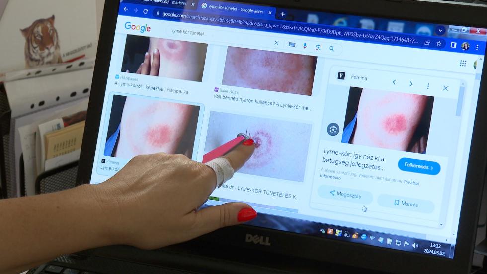 Magyarországon is felbukkant a vadászkullancs Magyarországon is felbukkant a vadászkullancs