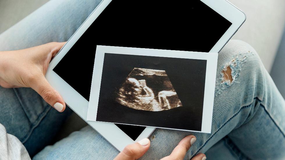 10 egyedi magyar név, amelyek már engedélyezettek Magyarországon 10 egyedi magyar név, amelyek már engedélyezettek Magyarországon